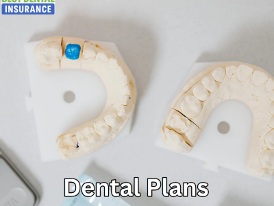 How Dental Discount Plans Work