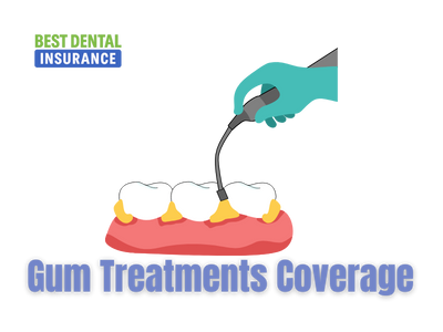 Gum Treatment Coverage