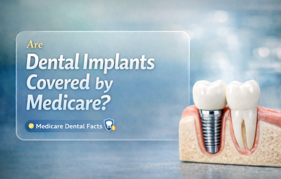 Choosing The right Plan for Implants